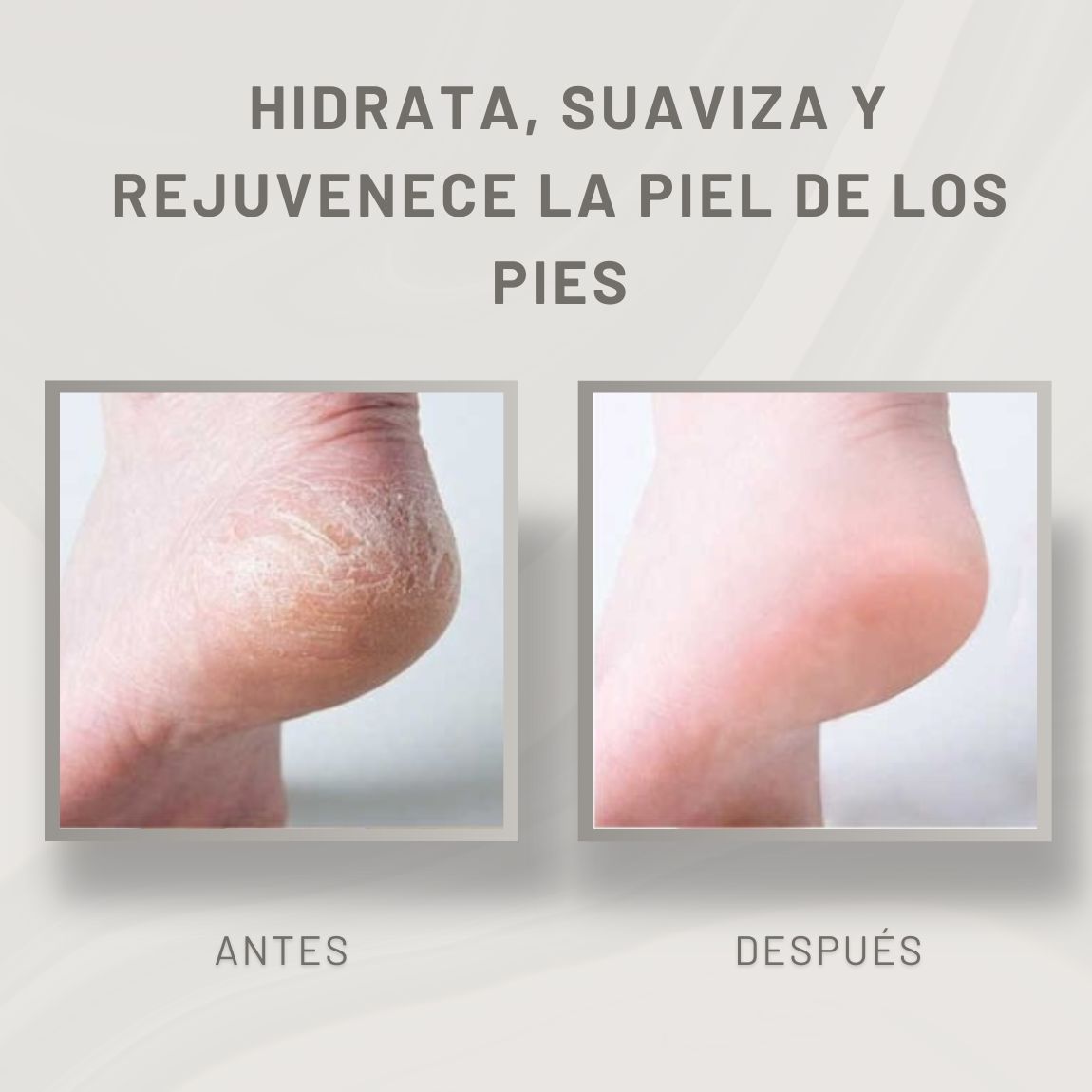 Cibelfoot Reblandecedor de durezas y callos-500ml